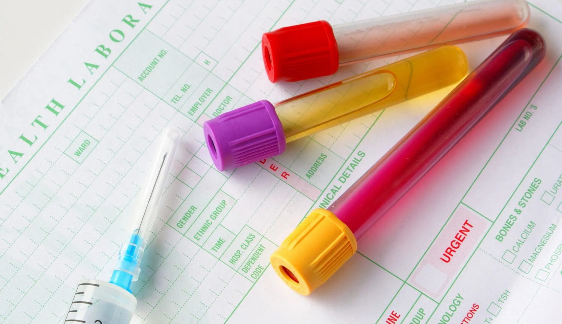 A close up of markers and a toothbrush on a calendar